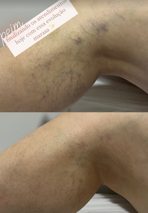 Depoimento de cliente 3